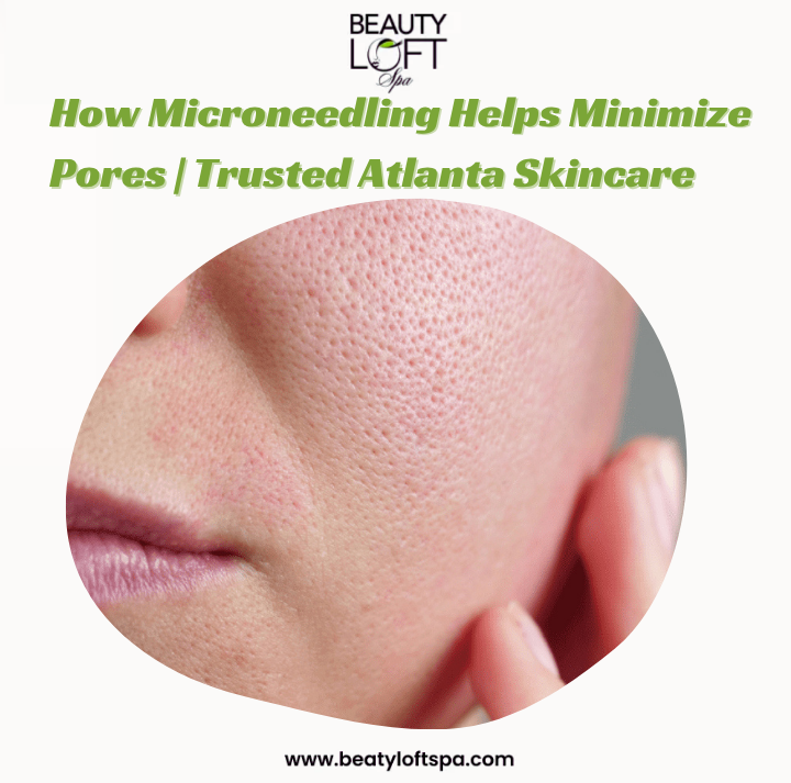 Unlocking Radiant Skin: How Microneedling Can Help Minimize Pores
