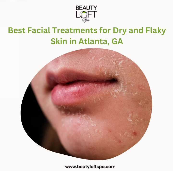Which Facial Treatment Works Best for Dry Skin in Atlanta’s Climate?