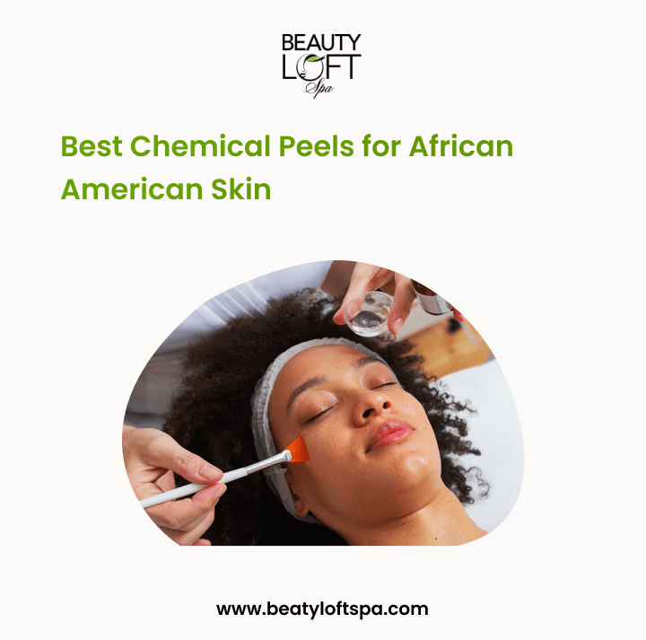 Best Chemical Peels for African American Skin