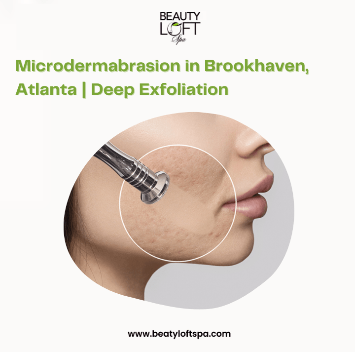 Diamond Tip Microdermabrasion in Atlanta: Reveal Smoother, Brighter Skin
