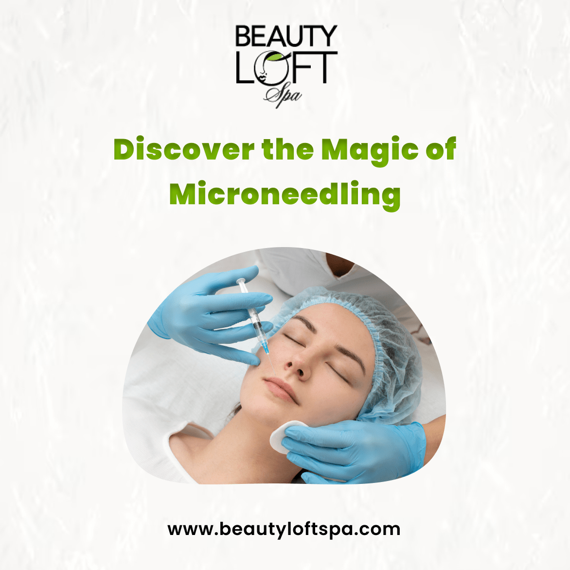 Discover the Magic of Microneedling: A Solution for Flawless Skin