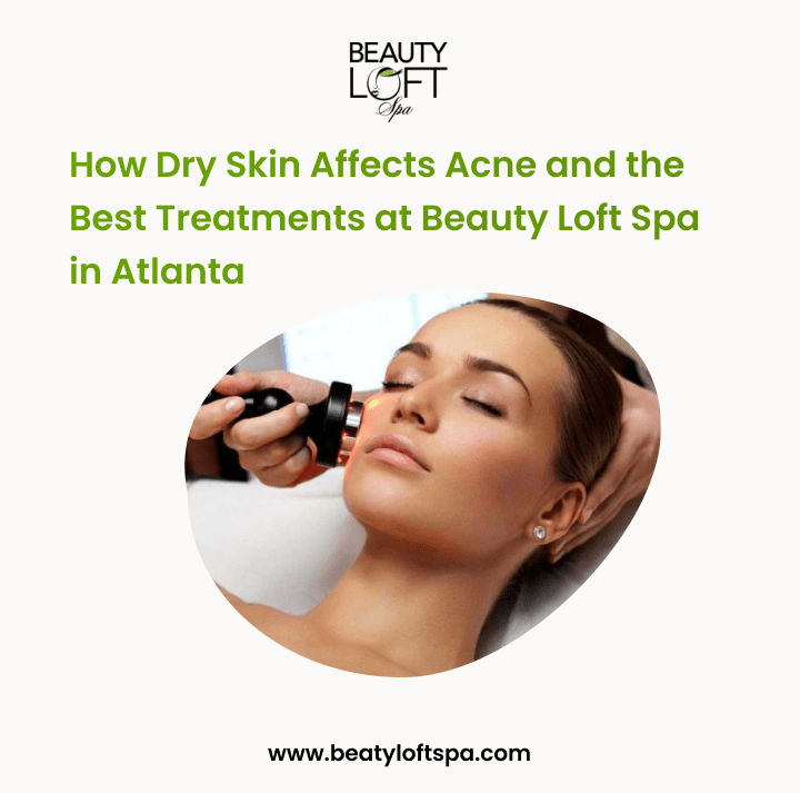 How Dry Skin Affects Acne and the Best Treatments at Beauty Loft Spa in Atlanta