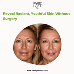 Non-Surgical Beauty in Atlanta: Mesotherapy for Skin Tightening and Radiance