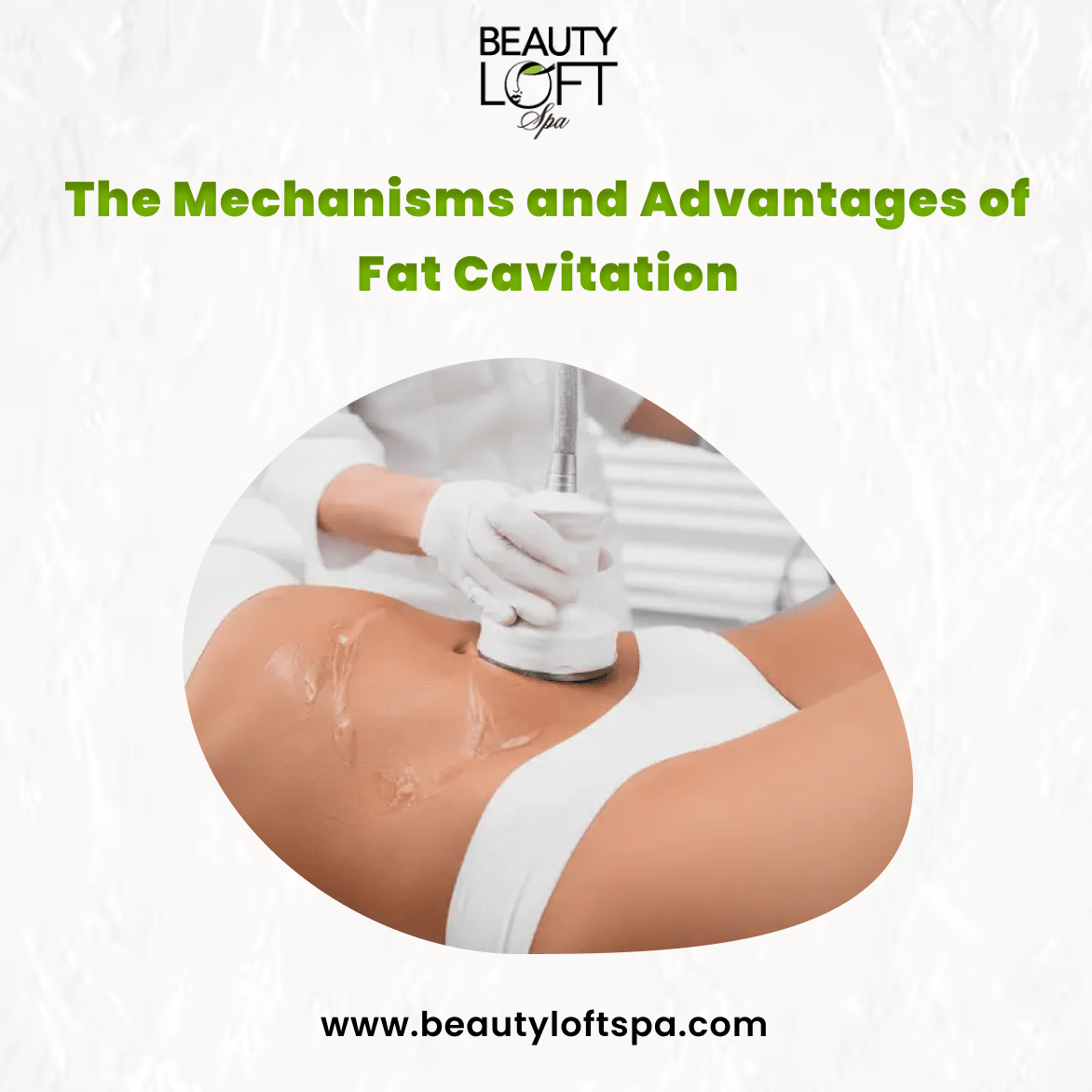 The Mechanisms and Advantages of Fat Cavitation