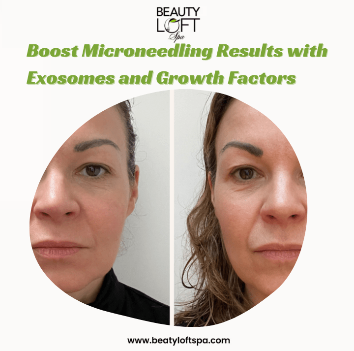 Understanding the Healing Process of Microneedling and How Beauty Loft Spa Enhances It