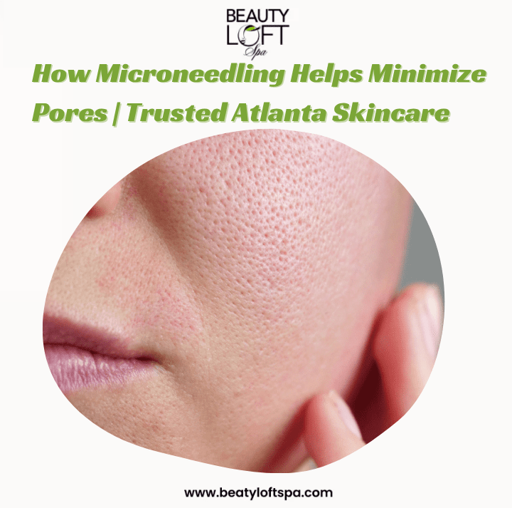 Unlocking Radiant Skin: How Microneedling Can Help Minimize Pores