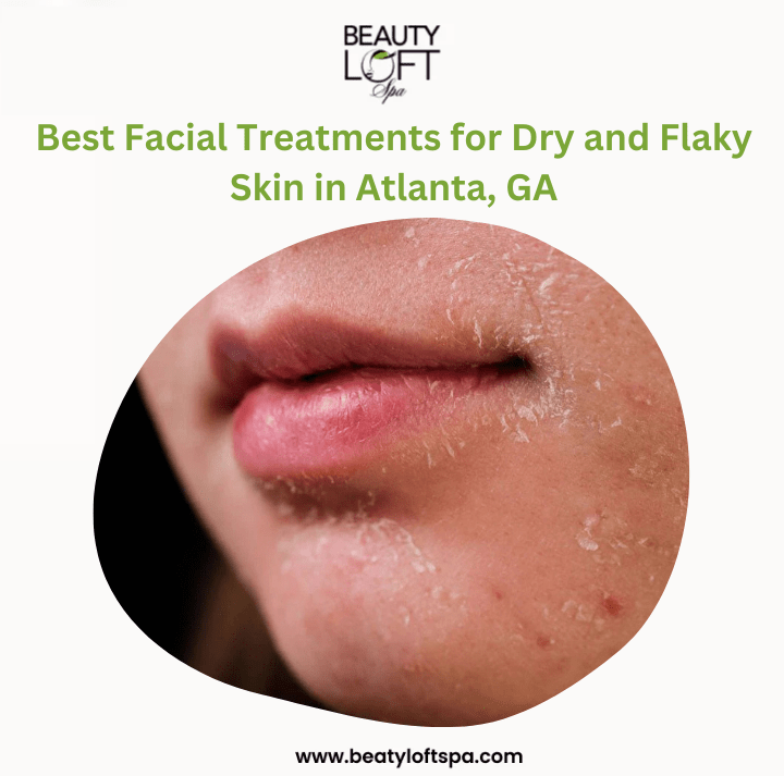 Which Facial Treatment Works Best for Dry Skin in Atlanta’s Climate?