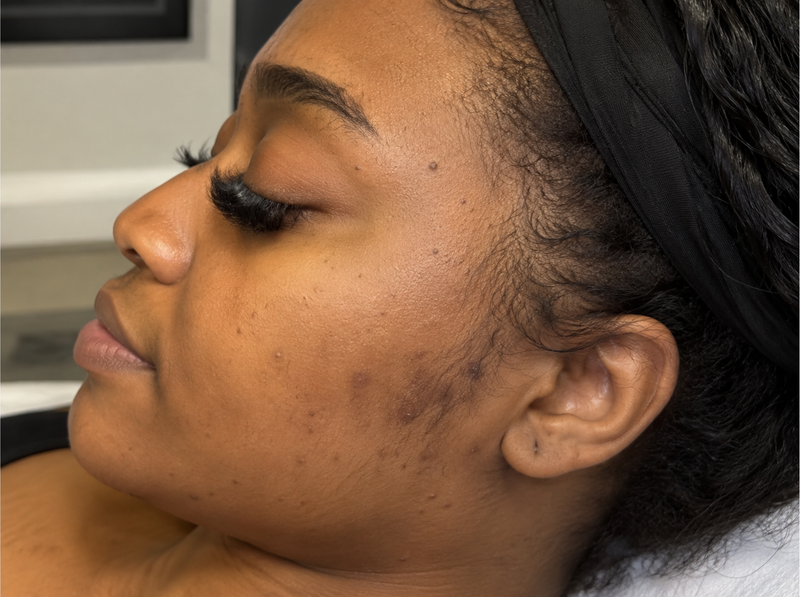 Before Treatment
