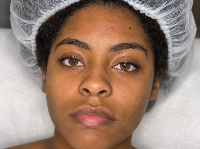 Before Treatment