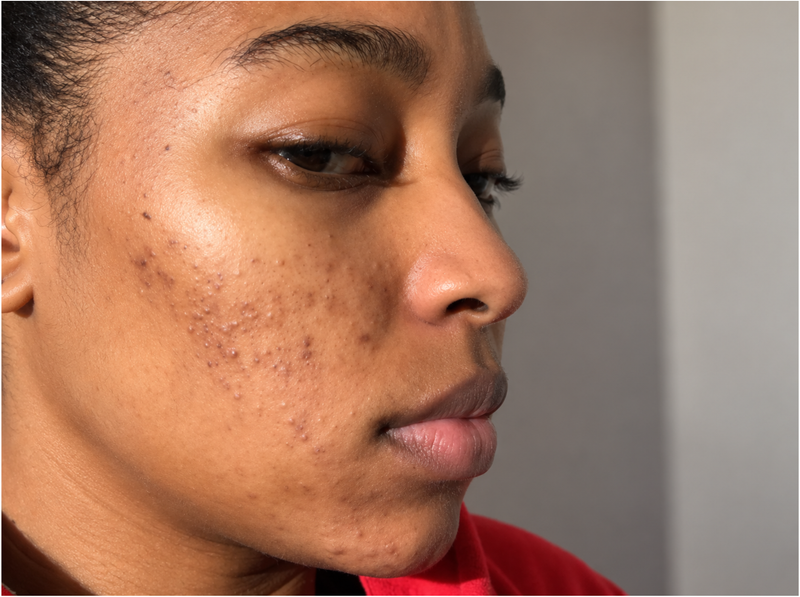 Before Treatment