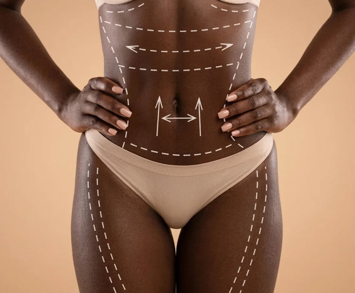 Body Contouring