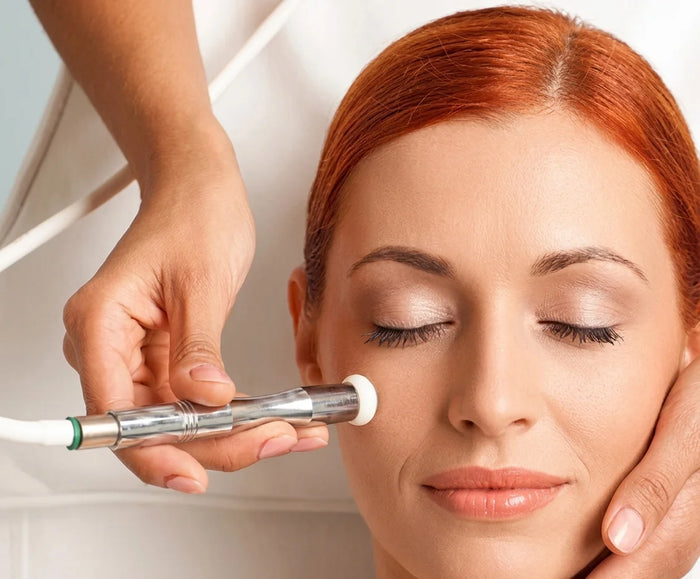 MICRODERMABRASION