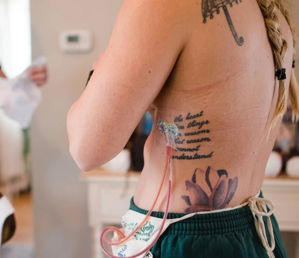 A New Approach to Postoperative Recovery