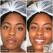 Teen Confidence Facial