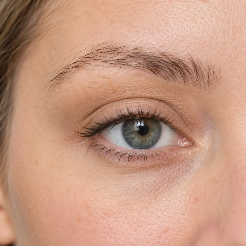 Before Treatment