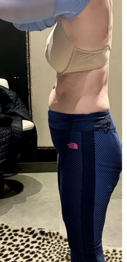 After Treatment