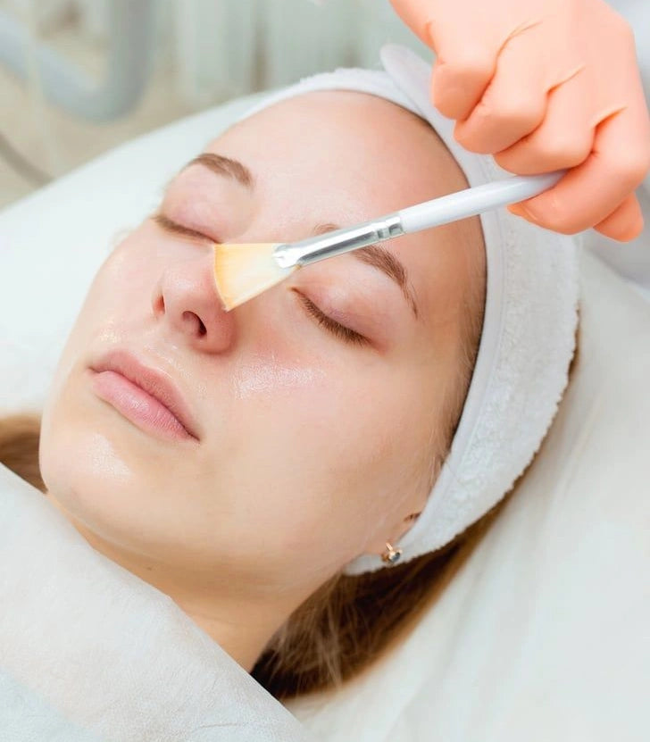 Chemical Peels