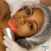 Microdermabrasion - Beauty Loft Spa