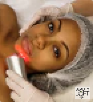 Microdermabrasion - Beauty Loft Spa